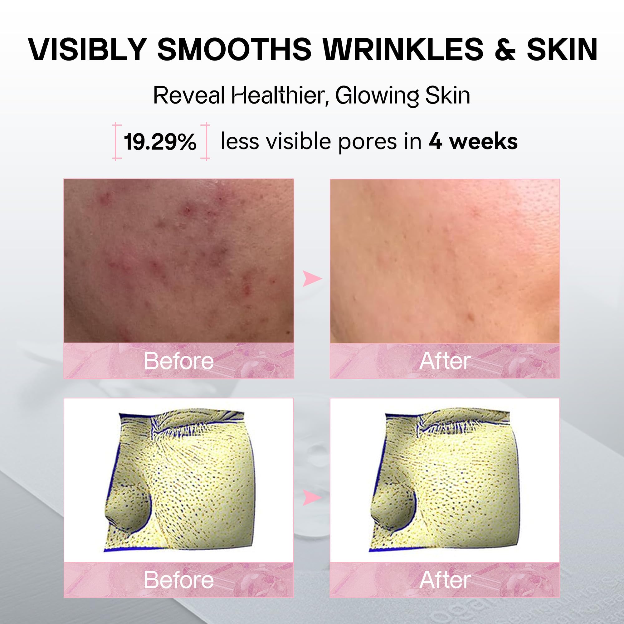 Amazon.com: OGANACELL DERX™ V-MODE 600 Booster Shot – PDRN Firming